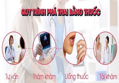Tư vấn phá thai bằng thuốc: Khi nào nên chọn phương pháp này?