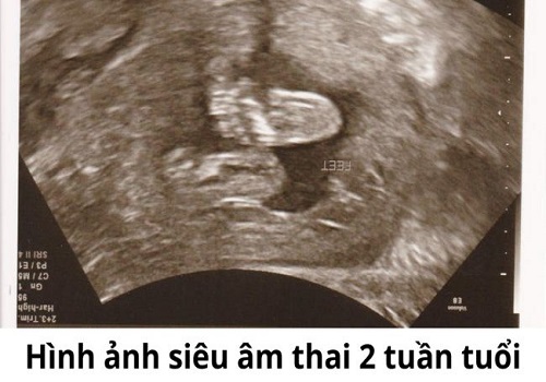 Những điều cần biết về cách phá thai 2 tuần tuổi an toàn