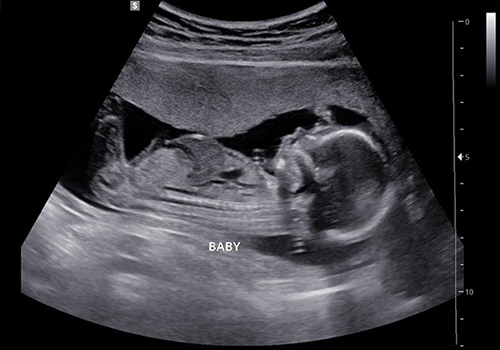 Đâu là phòng khám thai sản uy tín chất lượng tại Đắk Lắk