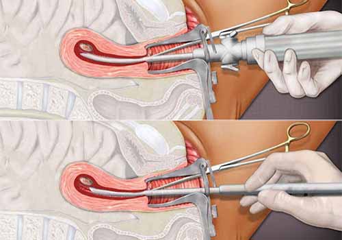 Hút thai giá khoảng bao nhiêu? Bảng giá mới cập nhật