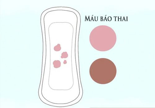 Những Điều Cần Biết Về Máu Báo Thai: Giải Đáp Chi Tiết Từ Chuyên Gia