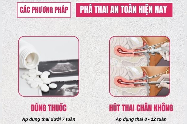 Cơ sở phá thai an toàn, bảo mật, tư vấn online miễn phí 24/24