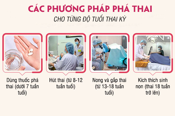Giới thiệu phòng khám phá thai được nhiều chị em lựa chọn tại Đắk Lắk