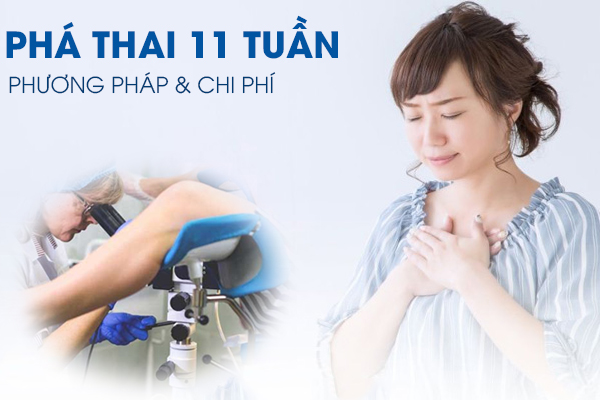 Phương pháp phá thai 11 tuần an toàn và ít đau