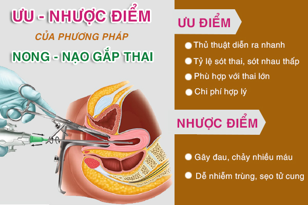 Phá thai 13 tuần: Thông tin chi tiết về phương pháp và chi phí