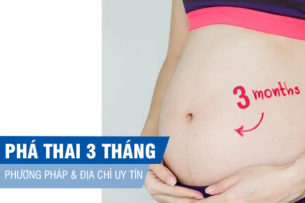 Cách phá thai 3 tháng an toàn, bảo vệ sức khỏe sinh sản