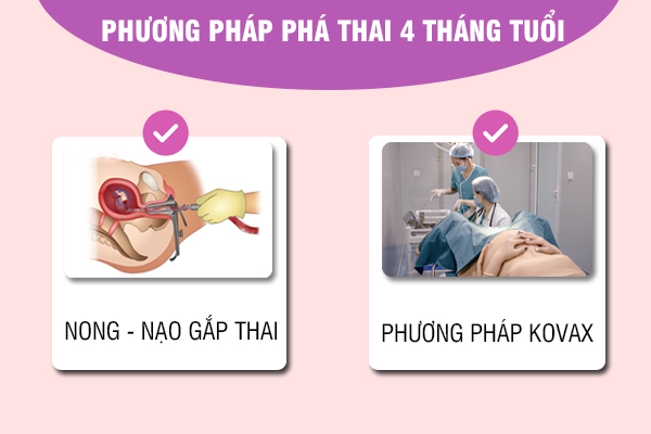 Phá thai 4 tháng có được không? - Chuyên gia giải đáp