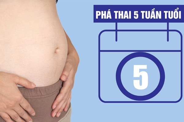 Cách phá thai 5 tuần an toàn, ít ảnh hưởng sức khỏe