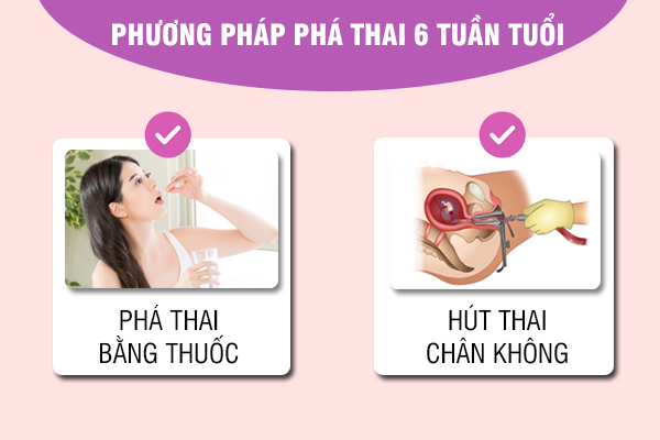 Tổng hợp phương pháp phá thai 6 tuần và địa chỉ uy tín