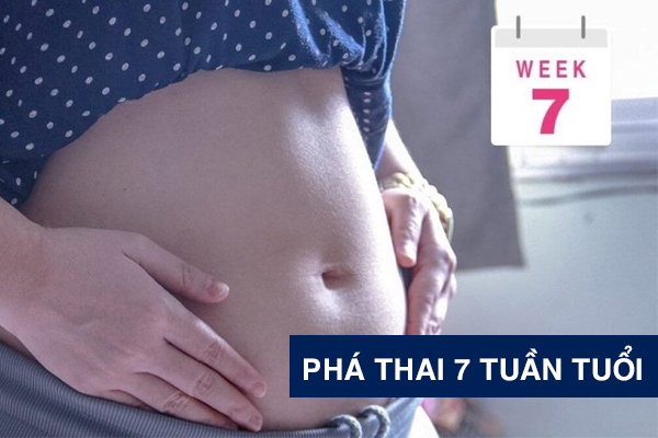 Cách phá thai 7 tuần an toàn, ít đau và hạn chế biến chứng